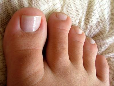 Nail Surgery