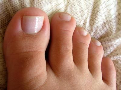 Nail Surgery